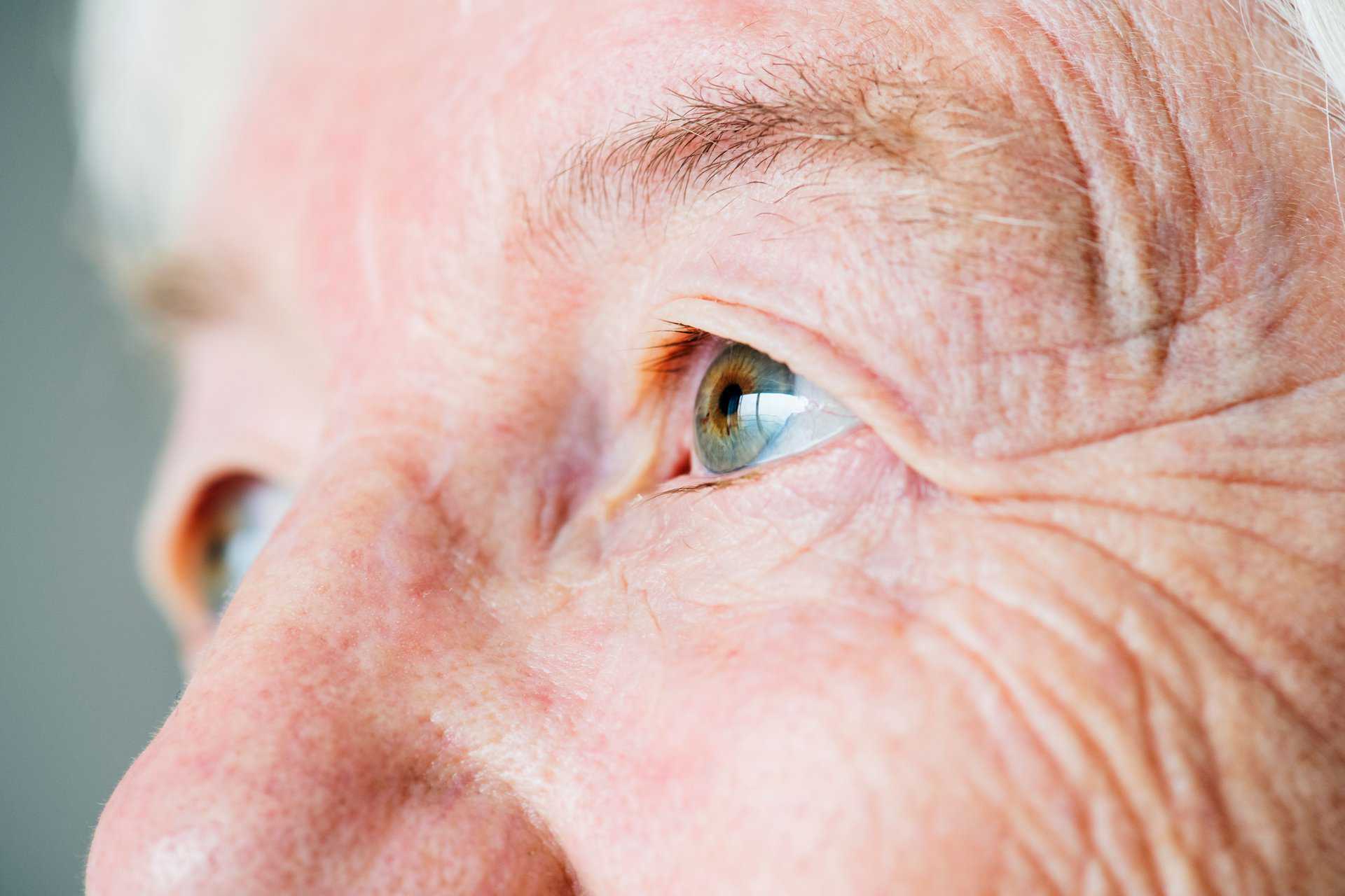Featured image for “Dry Eyes and Aging: A Guide for Older Adults”